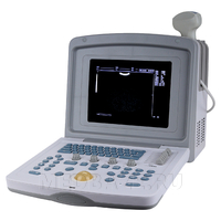 УЗИ сканер Med-Mos (CMS600B3)